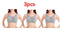 Cotton Anti-expansion Anti-Sag Gathering Adjustment Sports Bra MultyPros